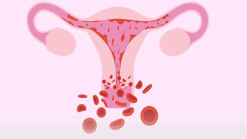 When to Worry About Heavy Menstrual Bleeding