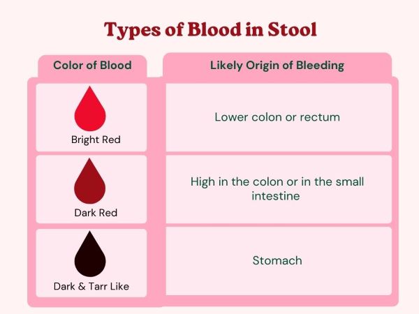 When To Worry About Blood in Stools